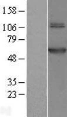 Western Blot: TRMT61B Overexpression Lysate (Adult Normal) [NBL1-10756] Left-Empty vector transfected control cell lysate (HEK293 cell lysate); Right -Over-expression Lysate for TRMT61B.