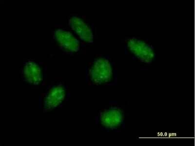 Immunocytochemistry/Immunofluorescence: TRMT9B Antibody [H00057604-B01P] - Analysis of purified antibody to KIAA1456 on HeLa cell. (antibody concentration 10 ug/ml)