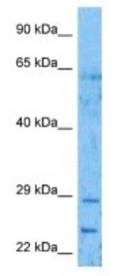 Western Blot: TRNP1 Antibody [NBP3-09899] - Western blot analysis of TRNP1 in ACHN Whole Cell lysates. Antibody dilution at 1ug/ml