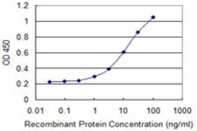 Sandwich ELISA: TRNT1 Antibody (1G11) [H00051095-M01] - Detection limit for recombinant GST tagged TRNT1 is 0.3 ng/ml as a capture antibody.