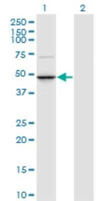 Western Blot: TRNT1 Antibody (1G11) [H00051095-M01] - Analysis of TRNT1 expression in transfected 293T cell line by TRNT1 monoclonal antibody (M01), clone 1G11.Lane 1: TRNT1 transfected lysate (Predicted MW: 46.4 KDa).Lane 2: Non-transfected lysate.