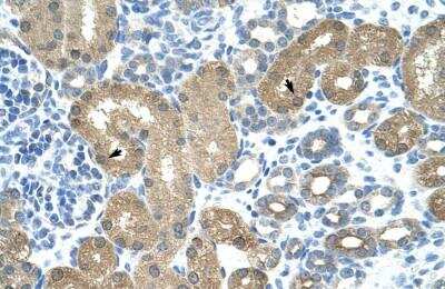 Immunohistochemistry-Paraffin: TRNT1 Antibody [NBP1-57224] - Human kidney Tissue, antibody concentration 4-8ug/ml. Cells with positive label: renal corpuscle cells (indicated with arrows) 400X magnification.