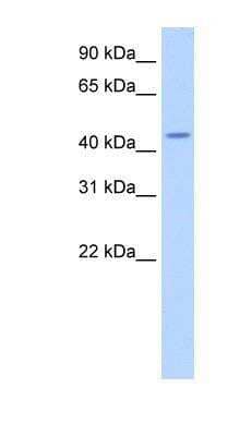 Western Blot: TRNT1 Antibody [NBP1-57224] - Antibody Titration: 2.5ug/ml ELISA Titer: 1:62500 Positive Control: Human brain