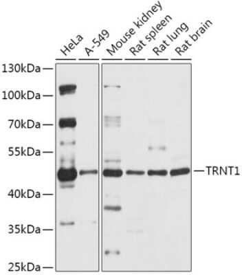 Western Blot: TRNT1 Antibody [NBP2-94361] - Analysis of extracts of various cell lines, using TRNT1 at 1:1000 dilution. Secondary antibody: HRP Goat Anti-Rabbit IgG (H+L) at 1:10000 dilution. Lysates/proteins: 25ug per lane. Blocking buffer: 3% nonfat dry milk in TBST. Detection: ECL Basic Kit . Exposure time: 30s.