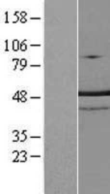 Western Blot: TRNT1 Overexpression Lysate (Adult Normal) [NBL1-17327] Left-Empty vector transfected control cell lysate (HEK293 cell lysate); Right -Over-expression Lysate for TRNT1.