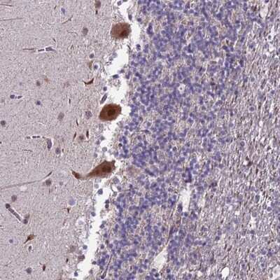 Immunohistochemistry-Paraffin TROAP Antibody