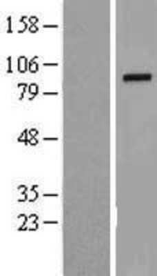 Western Blot: TROAP Overexpression Lysate (Adult Normal) [NBL1-17328] Left-Empty vector transfected control cell lysate (HEK293 cell lysate); Right -Over-expression Lysate for TROAP.