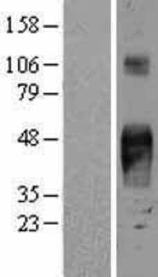 Western Blot: TROP2 Overexpression Lysate (Adult Normal) [NBL1-16675] Left-Empty vector transfected control cell lysate (HEK293 cell lysate); Right -Over-expression Lysate for TROP2.