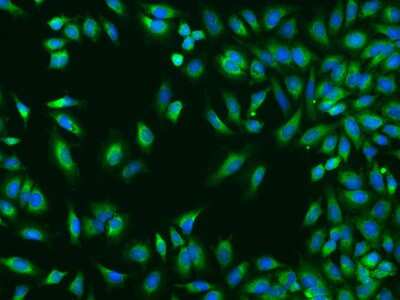 Immunocytochemistry/Immunofluorescence: TROVE2 Antibody [NBP2-98552] - Immunofluorescence staining of TROVE2 in HeLa cells. Cells were fixed with 4% PFA, permeabilzed with 0.1% Triton X-100 in PBS, blocked with 10% serum, and incubated with rabbit anti-Human TROVE2 polyclonal antibody (dilution ratio 1:200) at 4C overnight. Then cells were stained with the Alexa Fluor(R)488-conjugated Goat Anti-rabbit IgG secondary antibody (green) and counterstained with DAPI (blue).Positive staining was localized to Cytoplasm.