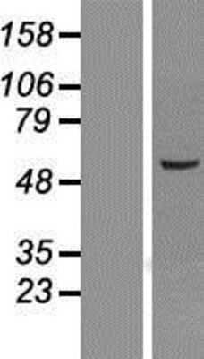 Western Blot: TROVE2 Overexpression Lysate (Adult Normal) [NBP2-07850] Left-Empty vector transfected control cell lysate (HEK293 cell lysate); Right -Over-expression Lysate for TROVE2.