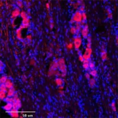 Immunocytochemistry/Immunofluorescence: TRPC1 Antibody [NB100-98844] - IF (confocal) on rat trigeminal at 1 : 500 dilution using Rabbit antibody to 2d extracellular loop of TRPC1: whole serum, DAPI counterstained appearing in blue.