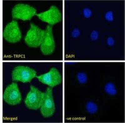 Immunocytochemistry/Immunofluorescence: TRPC1 Antibody [NBP2-62000] - Paraformaldehyde fixed U2OS cells, permeabilized with 0.15% Triton. Primary incubation 1hr (10 ug/ml) followed by Alexa Fluor 488 secondary antibody (4 ug/ml), showing nuclear and cytoplasmic staining. The nuclear stain is DAPI (blue). Negative control: Unimmunized goat IgG (10 ug/ml) followed by Alexa Fluor 488 secondary antibody (4 ug/ml).