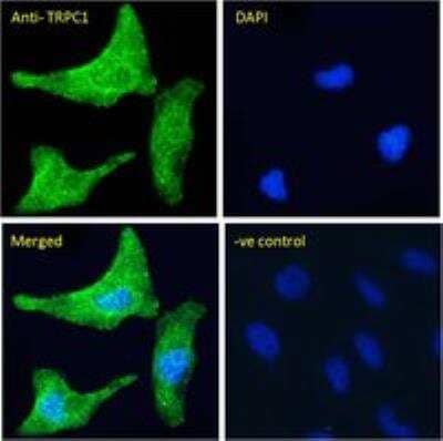 Immunocytochemistry/Immunofluorescence: TRPC1 Antibody [NBP2-62000] - Paraformaldehyde fixed HeLa cells, permeabilized with 0.15% Triton. Primary incubation 1hr (10 ug/ml) followed by Alexa Fluor 488 secondary antibody (4 ug/ml), showing cytoplasmic/Vesicle staining. The nuclear stain is DAPI (blue). Negative control: Unimmunized goat IgG (10 ug/ml) followed by Alexa Fluor 488 secondary antibody (4 ug/ml).