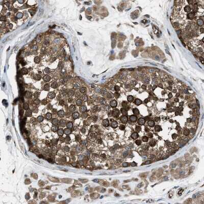 Immunohistochemistry-Paraffin: TRPC1 Antibody [NBP1-89648] - Staining of human testis shows strong cytoplasmic positivity in cells of seminiferus ducts.