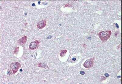 Immunohistochemistry-Paraffin: TRPC1 Antibody [NBP2-62000] - Paraffin embedded human cortex. Antibody at 3.75 ug/ml. Steamed antigen retrieval with citrate buffer pH 6, AP-staining.