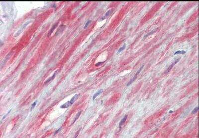 Immunohistochemistry-Paraffin: TRPC1 Antibody [NBP2-62000] - Paraffin embedded human prostate. Antibody at 3.75 ug/ml. Steamed antigen retrieval with citrate buffer pH 6, AP-staining.