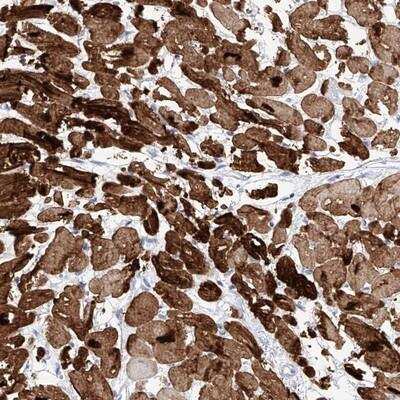 Immunohistochemistry-Paraffin: TRP7 Antibody [NBP1-87523] - Staining of human heart muscle shows strong cytoplasmic and nuclear positivity in myocytes.