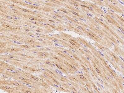 Immunohistochemistry-Paraffin: TRP7 Antibody [NBP2-99522] - Immunochemical staining of human TRP7 in cynomolgus heart with rabbit polyclonal antibody at 1:300 dilution, formalin-fixed paraffin embedded sections.