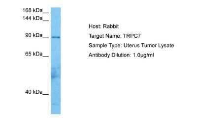 Western Blot: TRP7 Antibody [NBP2-88489] - Host: Rabbit. Target Name: TRPC7. Sample Tissue: Human Uterus Tumor lysates. Antibody Dilution: 1ug/ml