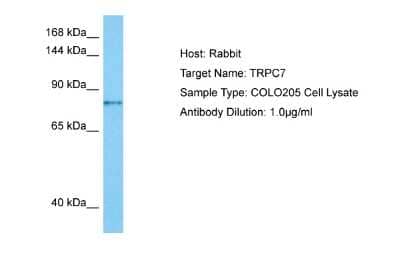 Western Blot: TRP7 Antibody [NBP2-88490] - Host: Rabbit. Target Name: TRPC7. Sample Tissue: Human COLO205 Whole Cell lysates. Antibody Dilution: 1ug/ml