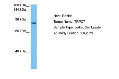 Western Blot: TRP7 Antibody [NBP2-88491] - Host: Rabbit. Target Name: TRPC7. Sample Tissue: Human Jurkat Whole Cell lysates. Antibody Dilution: 1ug/ml