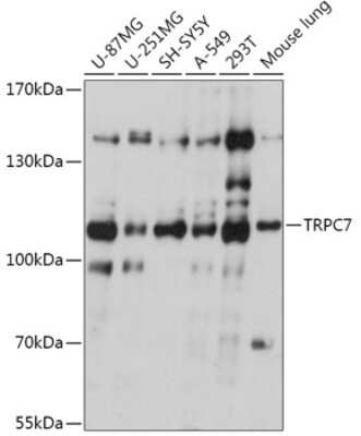 Western Blot: TRP7 Antibody [NBP2-94388] - Analysis of extracts of various cell lines, using TRP7 at 1:1000 dilution. Secondary antibody: HRP Goat Anti-Rabbit IgG (H+L) at 1:10000 dilution. Lysates/proteins: 25ug per lane. Blocking buffer: 3% nonfat dry milk in TBST. Detection: ECL Basic Kit . Exposure time: 30s.