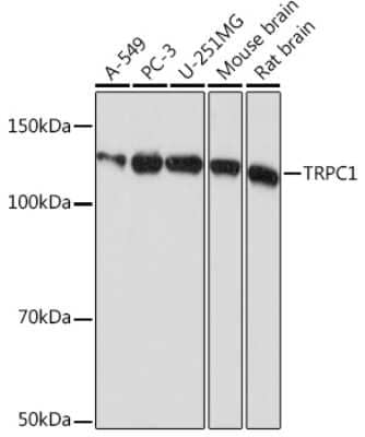 Western Blot: TRPC1 Antibody (1V3Q2) [NBP3-16315] - Western blot analysis of extracts of various cell lines, using TRPC1 Rabbit mAb (NBP3-16315) at 1:1000 dilution. Secondary antibody: HRP Goat Anti-Rabbit IgG (H+L) at 1:10000 dilution. Lysates/proteins: 25ug per lane. Blocking buffer: 3% nonfat dry milk in TBST. Detection: ECL Basic Kit. Exposure time: 5s.