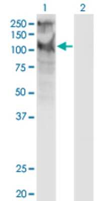 Western Blot TRPC5 Antibody (1C8)