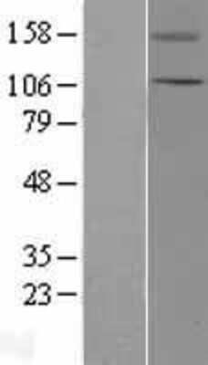 Western Blot TRPC5 Overexpression Lysate