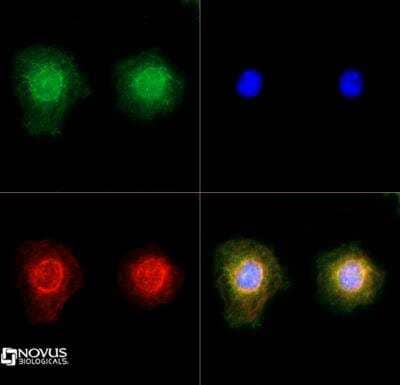 Immunocytochemistry/Immunofluorescence: TRPM2 Antibody [NB110-82364] - TRPM2 antibody was tested in Neuro2A cells with DyLight 488 (green). Nuclei and alpha-tubulin were counterstained with DAPI (blue) and Dylight 550 (red). 