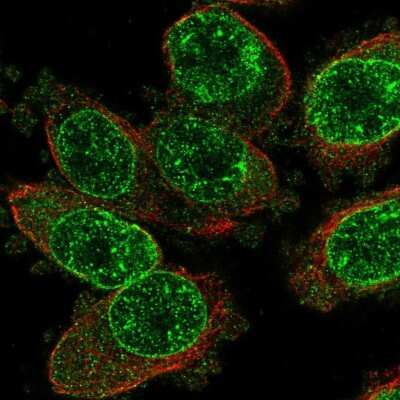 Immunocytochemistry/Immunofluorescence: TRPM2 Antibody [NBP2-58306] - Staining of human cell line PC-3 shows localization to nuclear membrane.