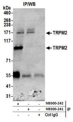 Immunoprecipitation: TRPM2 Antibody [NB500-242] - Samples: Membrane Prep (0.5 or 1.0 mg per IP reaction; 20% of IP loaded) from Jurkat cells. Antibodies: Affinity purified rabbit anti-TRPM2 antibody NB500-242 used for IP at 6 ug per reaction. TRPM2 was also immunoprecipitated by rabbit anti-TRPM2 antibody NB500-241. For blotting immunoprecipitated TRPM2, NB500-242 was used at 1 ug/ml. Detection: Chemiluminescence with an exposure time of 30 seconds.