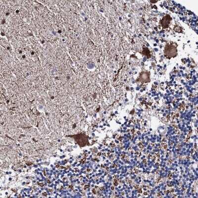 Immunohistochemistry: TRPM2 Antibody [NBP2-48635] - Staining of human cerebellum shows strong cytoplasmic positivity in Purkinje cells.