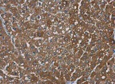 Immunohistochemistry-Paraffin: TRPM2 Antibody [NBP1-33416] - Paraffin-embedded rat liver. TRPM2 antibody [N1N2-2], N-term diluted at 1:500.