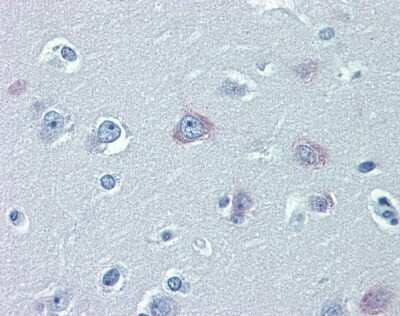 Immunohistochemistry-Paraffin: TRPM2 Antibody [NBP1-59618] - human LCL and mouse brains incubated for 5 minutes in CDP-Star for 5 minutes tissue.