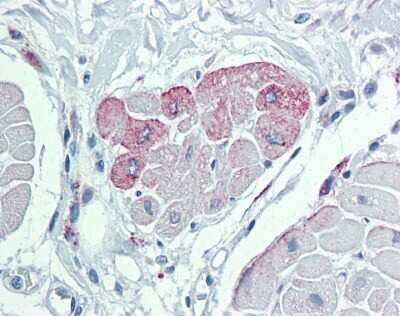 Immunohistochemistry-Paraffin: TRPM2 Antibody [NBP1-59618] - Human Heart Tissue, 10-20 ug/ml antibody concentration.