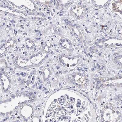 Immunohistochemistry-Paraffin: TRPM2 Antibody [NBP2-48635] - Staining of human kidney shows low expression as expected.