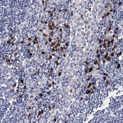 Immunohistochemistry-Paraffin: TRPM2 Antibody [NBP2-48635] - Staining of human lymph node shows high expression.