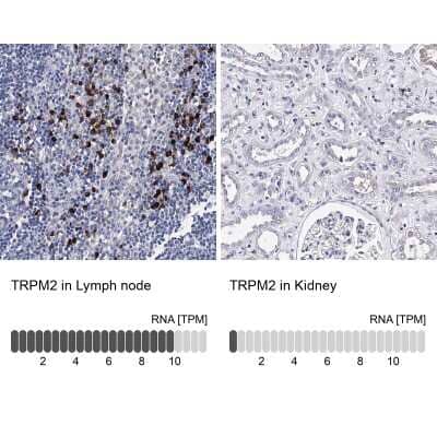 <b>Orthogonal Strategies Validation. </b>Immunohistochemistry-Paraffin: TRPM2 Antibody [NBP2-48635] - Staining in human lymph node and kidney tissues using anti-TRPM2 antibody. Corresponding TRPM2 RNA-seq data are presented for the same tissues.