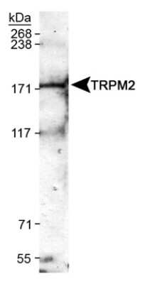 Western Blot: TRPM2 Antibody [NB110-82364] - Detection of TRPM2 in mouse brain membrane lysates using NB110-82364.