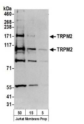 Western Blot: TRPM2 Antibody [NB500-242] - Samples: Jurkat Membrane Prep (50, 15, 5 ug). Antibody: Affinity purified rabbit anti-TRPM2 antibody used for WB at 0.1 ug/ml. Detection: Chemiluminescence with an exposure time of 3 minutes.