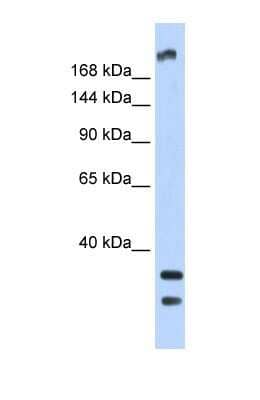 Western Blot: TRPM2 Antibody [NBP1-59618] - Human Fetal Brain Lysate, concentration 1ug/ml.