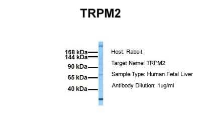 Western Blot: TRPM2 Antibody [NBP1-59618] - Sample Tissue: Human Fetal Liver Antibody Dilution: 1.0 ug/ml