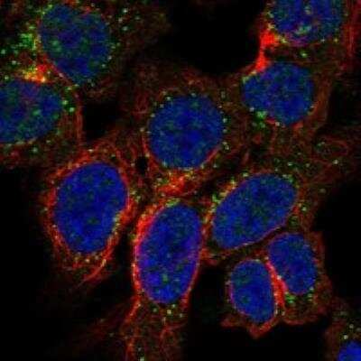 Immunocytochemistry/Immunofluorescence: TRPM3 Antibody [NBP3-17069] - Staining of human cell line HAP1 shows localization to vesicles.