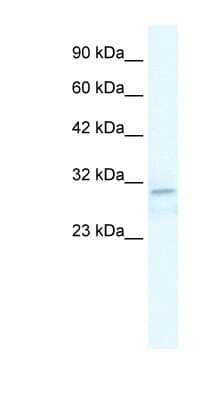 Western Blot: TRPM3 Antibody [NBP1-80210] - Jurkat cell lysate, concentration 2.5 ug/ml.