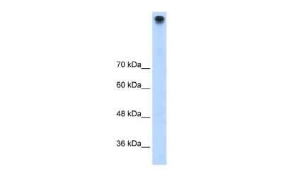 Western Blot: TRPM3 Antibody [NBP2-86876] - WB Suggested Anti-TRPM3 Antibody Titration: 1.25ug/ml. Positive Control: HepG2 cell lysate