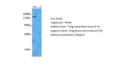 Western Blot: TRPM3 Antibody [NBP2-86876] - Host: Rabbit. Target: TRPM3. Positive control (+): Human testis (TE). Negative control (-): Human uterus (UT). Antibody concentration: 0.8ug/m