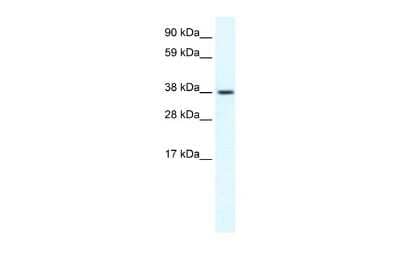 Western Blot: TRPM3 Antibody [NBP2-86877] - WB Suggested Anti-TRPM3 Antibody Titration: 1.25ug/ml. ELISA Titer: 1:1562500. Positive Control: Human cerebellum