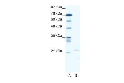 Western Blot: TRPM3 Antibody [NBP2-86878] - WB Suggested Anti-TRPM3 Antibody Titration: 0.2-1 ug/ml. ELISA Titer: 1:1562500. Positive Control: Jurkat cell lysate