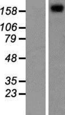 Western Blot: TRPM3 Overexpression Lysate (Adult Normal) [NBP2-06581] Left-Empty vector transfected control cell lysate (HEK293 cell lysate); Right -Over-expression Lysate for TRPM3.